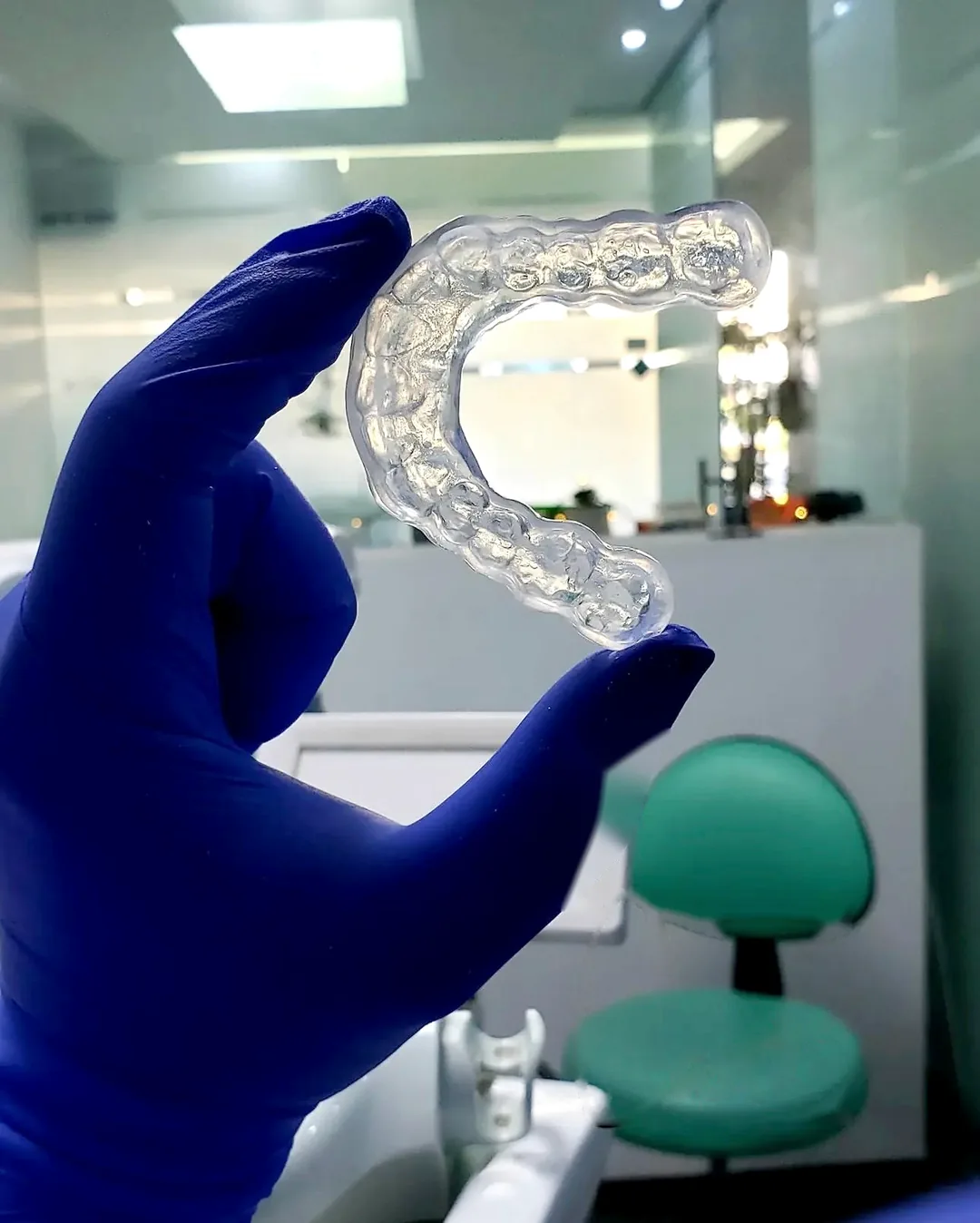 Férula de descarga transparente para bruxismo elaborada en Dental Correct Guadalajara